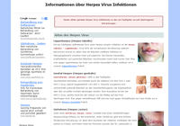 Herpes